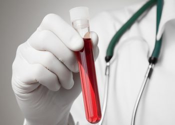 Причини та лікування тромбоцитозу