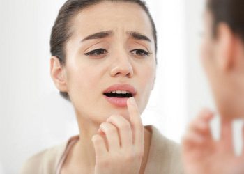 Як позбутися лихоманки на губах: 3 ефективні народні засоби