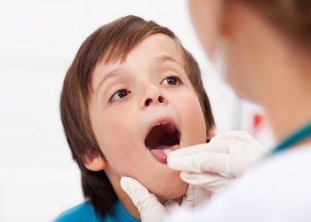 Як лікувати ангіну: поради лікаря-отоларинголога