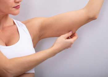 Що робити, коли обвисає шкіра рук