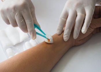 Що не варто наносити на відкриту рану