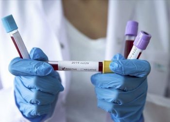 З’явилися симптоми коронавірусу: що робити?