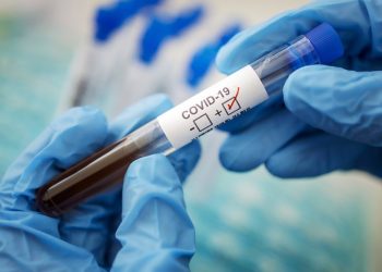 Лікар-інфекціоніст розповіла, як розвивається ковід