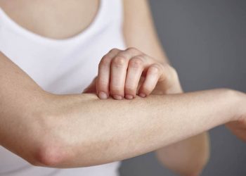 Чи виліковний псоріаз?