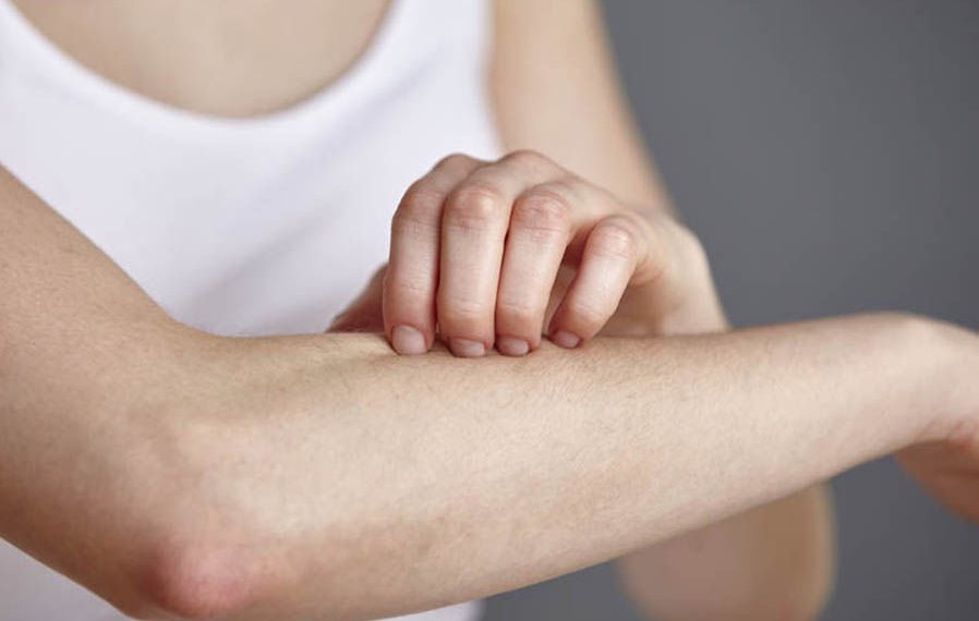 Чи виліковний псоріаз?