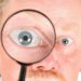 Вирячені очі вказують на ендокринні зміни