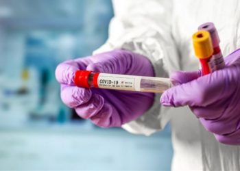 Постковідний синдром: питання та відповіді