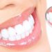 Пародонтит: як не залишитися без зубів