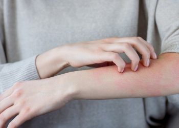 Шкірні хвороби і від стресу загострюються