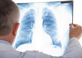 Як уберегтися від туберкульозу