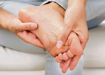 Чому п’яти тріскаються