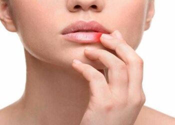 Заїди дають “зелене світло” інфекціям