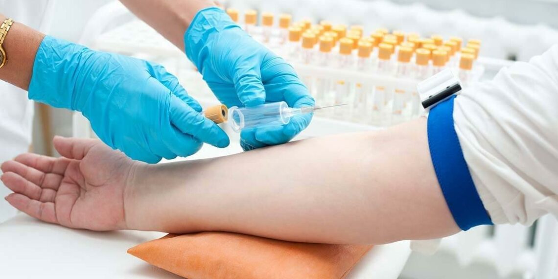 Здаємо кров із вени: як підготуватися