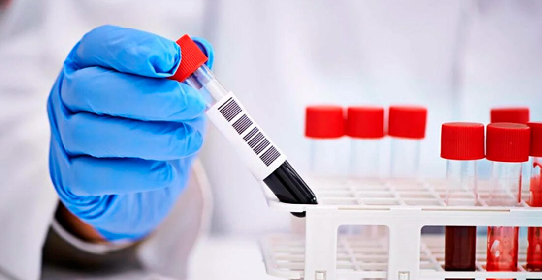 Для чого досліджують ШОЕ?