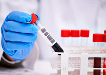 Для чого досліджують ШОЕ?