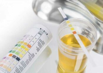 Як правильно здати аналіз сечі