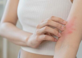 Алергія: як допомогти шкірі