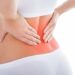 Радикуліт: як попередити напади