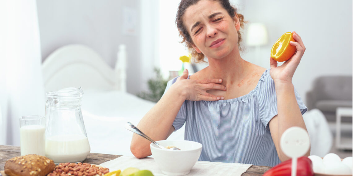 Харчова алергія: коли їжа — не на користь