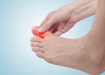 Що робити з шишками на ногах