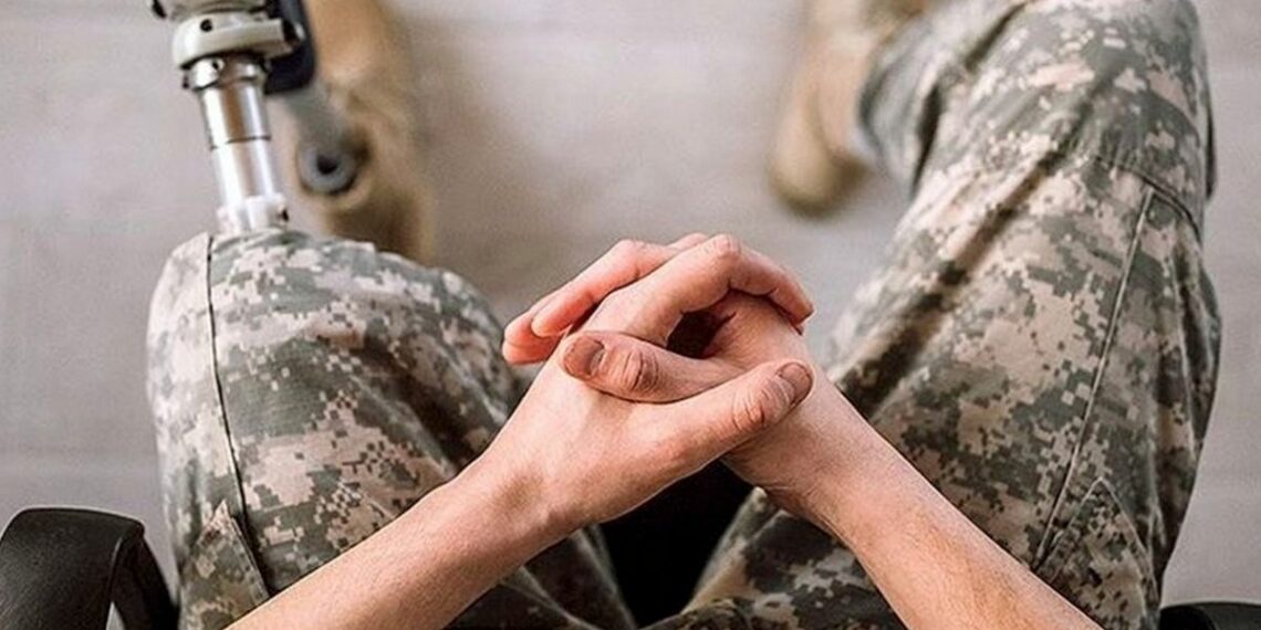 Спрощено доступ до протезування