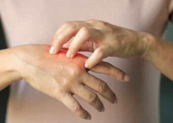 Щоб запідозрити грибок, достатньо огляду лікаря