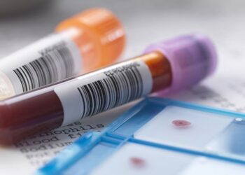 Навіщо потрібна щорічна ліпідограма