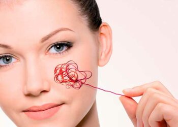 Судинні «зірочки»: коли варто турбуватися