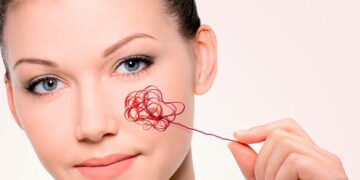 Судинні «зірочки»: коли варто турбуватися