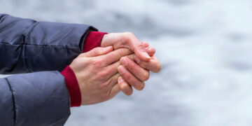 Усе про обмороження