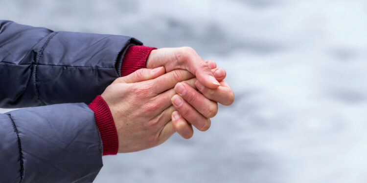 Усе про обмороження